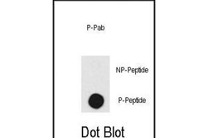 Dot blot analysis of anti-DNA-PK-p Pab (R) on nitrocellulose membrane. (PRKDC Antikörper  (pThr2609))