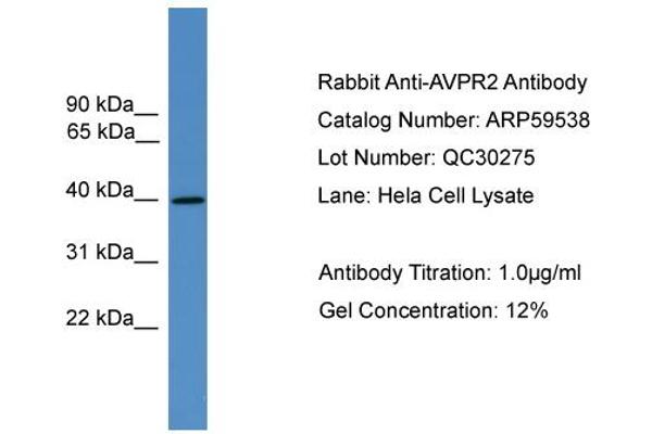 AVPR2 Antikörper  (C-Term)