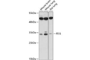 Western blot analysis of extracts of various cell lines, using PI15 antibody (ABIN7269205) at 1:1000 dilution. (PI15 Antikörper  (AA 61-170))