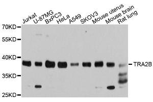 Western blot analysis of extracts of various cell lines, using TRA2B antibody. (TRA2B Antikörper)