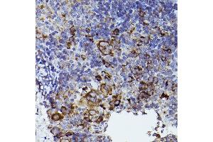 Immunohistochemistry of paraffin-embedded mouse spleen using THBS1 Rabbit pAb (ABIN3022978, ABIN3022979, ABIN3022980 and ABIN6219329) at dilution of 1:50 (40x lens). (Thrombospondin 1 Antikörper  (AA 80-360))