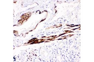 IHC analysis of Desmin using anti-Desmin antibody (ABIN3043265).