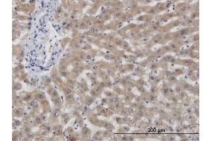 Immunoperoxidase of monoclonal antibody to CBS on formalin-fixed paraffin-embedded human liver. (CBS Antikörper  (AA 1-100))