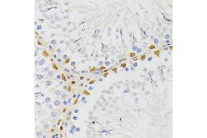 Immunohistochemistry of paraffin-embedded rat testis using EL antibody (ABIN6132052, ABIN6140108, ABIN6140109 and ABIN6222942) at dilution of 1:200 (40x lens). (ELAC2 Antikörper  (AA 1-270))