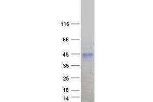 Western Blotting (WB) image for Plasminogen Activator, Urokinase Receptor (PLAUR) (Transcript Variant 2) protein (Myc-DYKDDDDK Tag) (ABIN2713802)