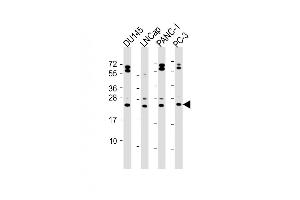 All lanes : Anti-Neurogenin3 Antibody (N-term) at 1:2000 dilution Lane 1: D whole cell lysate Lane 2: LNCap whole cell lysate Lane 3: NC-1 whole cell lysate Lane 4: PC-3 whole cell lysate Lysates/proteins at 20 μg per lane.