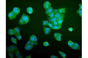 IF analysis of Aldolase/ALDOA using anti-Aldolase/ALDOA antibody (ABIN7601908). (ALDOA Antikörper  (AA 50-364))