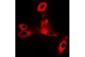 Immunofluorescence (IF) image for anti-CD47 (CD47) antibody (ABIN7307628)