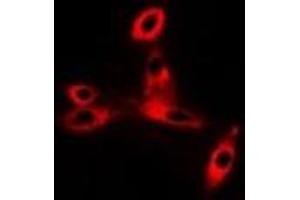 Immunofluorescent analysis of CD47 staining in Hela cells. (CD47 Antikörper)