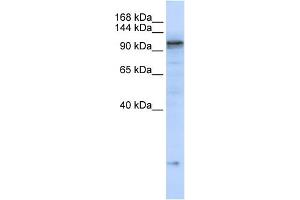 WB Suggested Anti-ATP2A2 Antibody Titration:  0. (ATP2A2 Antikörper  (C-Term))