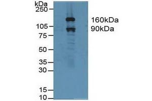 Detection of GSN in Human Hela Cells using Polyclonal Antibody to Gelsolin (GSN) (Gelsolin Antikörper  (AA 577-771))