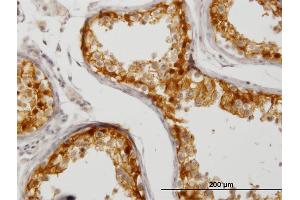 Immunostaining (ISt) image for anti-Cbp/p300-Interacting Transactivator, with Glu/Asp-Rich Carboxy-terminal Domain, 1 (CITED1) (AA 94-193) antibody (ABIN518016)