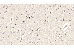Detection of AHSG in Bovine Cerebrum Tissue using Polyclonal Antibody to Alpha-2-Heremans Schmid Glycoprotein (AHSG) (Fetuin A Antikörper  (AA 19-359))