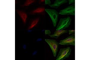 ABIN6261347 and ABIN6278392 staining  cells by IF/ICC.