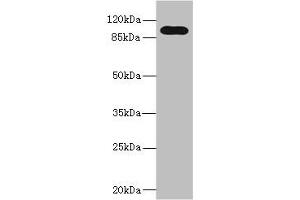 Western blot All lanes: TLR6 antibody at 5 μg/mL + Jurkat whole cell lysate Secondary Goat polyclonal to rabbit IgG at 1/10000 dilution Predicted band size: 92, 56 kDa Observed band size: 92 kDa (TLR6 Antikörper  (AA 32-586))