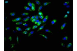 Immunofluorescence staining of Hela cells with ABIN7149787 at 1:166, counter-stained with DAPI. (Desmoglein 3 Antikörper  (AA 70-615))