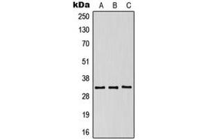 Western blot analysis of CD158g expression in HeLa (A), SP2/0 (B), NIH3T3 (C) whole cell lysates.