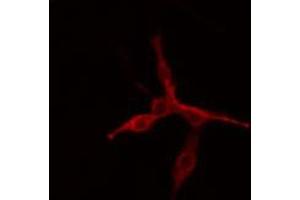 ABIN6272344 staining COLO205 cells by IF/ICC. (MAP4K6 Antikörper  (Internal Region))