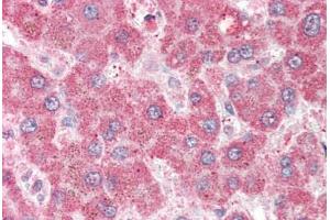 Human Liver (formalin-fixed, paraffin-embedded) stained with MPP6 antibody ABIN337016 at 5 ug/ml followed by biotinylated anti-goat IgG secondary antibody ABIN481715, alkaline phosphatase-streptavidin and chromogen. (MPP6 Antikörper  (AA 2-14))