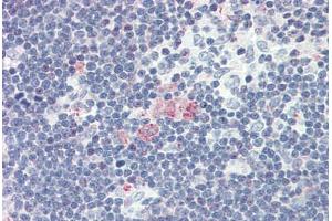 Human Thymus (formalin-fixed, paraffin-embedded) stained with CXCL12 antibody ABIN337163 at 5 ug/ml followed by biotinylated goat anti-rabbit IgG secondary antibody ABIN481713, alkaline phosphatase-streptavidin and chromogen. (CXCL12 Antikörper)