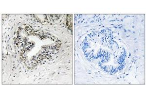 Immunohistochemistry analysis of paraffin-embedded human prostate carcinoma tissue using RPL30 antibody. (RPL30 Antikörper  (C-Term))