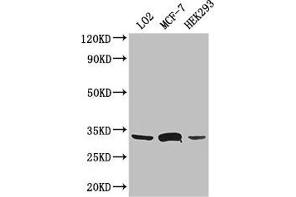 SLC25A6 Antikörper  (AA 144-175)