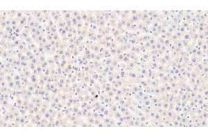 Detection of CPA1 in Rat Liver Tissue using Polyclonal Antibody to Carboxypeptidase A1, Pancreatic (CPA1) (CPA1 Antikörper  (AA 205-419))