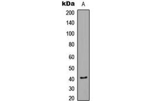 Western blot analysis of CaMK1 alpha (pT177) expression in Jurkat Insulin-treated (A) whole cell lysates.