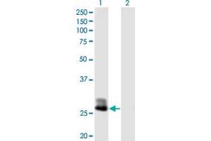 Western Blot analysis of CFHR2 expression in transfected 293T cell line by CFHR2 MaxPab polyclonal antibody. (CFHR2 Antikörper  (AA 1-270))