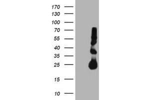 Western Blotting (WB) image for anti-Metalloproteinase Inhibitor 2 (TIMP2) antibody (ABIN1501394) (TIMP2 Antikörper)