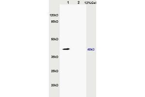 L1 rat kidney lysates L2 rat brain lysates probed with Anti ZNF379/ZDHHC9 Polyclonal Antibody, Unconjugated (ABIN715676) at 1:200 in 4 °C. (ZDHHC9 Antikörper  (AA 118-155))