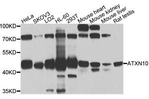 Western blot analysis of extracts of various cell lines, using ATXN10 antibody (ABIN5972628) at 1/1000 dilution. (Ataxin 10 Antikörper)
