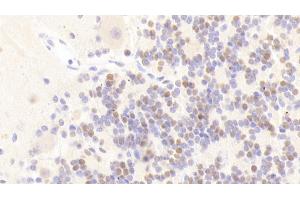 Detection of ANP32A in Human Cerebellum Tissue using Polyclonal Antibody to Acidic Nuclear Phosphoprotein 32 Family, Member A (ANP32A) (PHAP1 Antikörper  (AA 2-175))