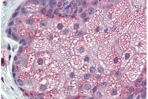 Anti-TM9SF3 antibody IHC staining of skin, sebaceous gland, human. (TM9SF3 Antikörper  (Internal Region))