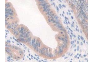 IHC-P analysis of Mouse Uterus Tissue, with DAB staining. (CFP Antikörper  (AA 54-217))