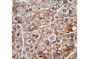 Immunohistochemistry (IHC) image for anti-Bone Morphogenetic Protein Receptor, Type II (serine/threonine Kinase) (BMPR2) (AA 27-56) antibody (ABIN3030193)