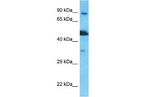 Host:  Rabbit  Target Name:  NSUN2  Sample Type:  PANC1 Whole Cell lysates  Antibody Dilution:  1. (NSUN2 Antikörper  (N-Term))