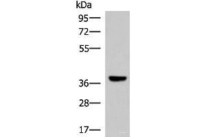 Western blot analysis of Mouse liver tissue lysate using LRG1 Polyclonal Antibody at dilution of 1:1000 (LRG1 Antikörper)