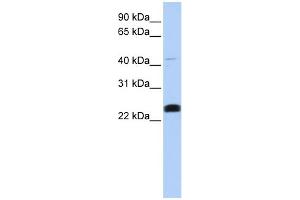 WB Suggested Anti-LYCAT Antibody Titration:  0. (LCLAT1 Antikörper  (Middle Region))