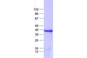 Western Blotting (WB) image for F-Box Protein 17 (FBXO17) protein (His tag) (ABIN2720936)