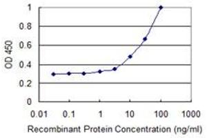 Detection limit for recombinant GST tagged AKTIP is 1 ng/ml as a capture antibody. (AKTIP Antikörper  (AA 1-292))
