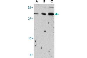 Western blot analysis of Il31 in Raw 264. (IL-31 Antikörper  (N-Term))