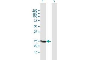 Western Blot analysis of FAM119B expression in transfected 293T cell line by FAM119B MaxPab polyclonal antibody. (Methyltransferase Like 21B (METTL21B) (AA 1-226) Antikörper)