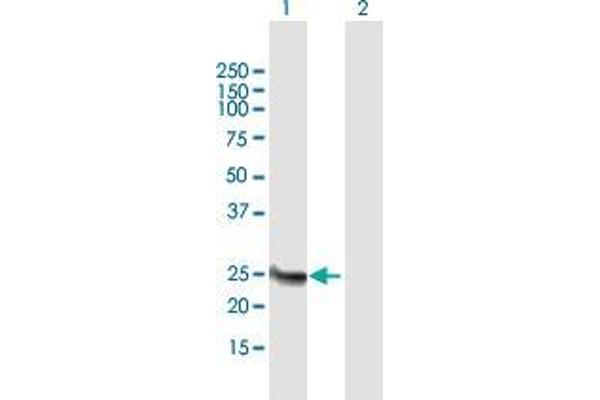 Methyltransferase Like 21B (METTL21B) (AA 1-226) Antikörper