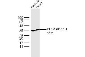 Lane 1: Muscle lysates Lane 2: Heart lysates probed with PP2A alpha + beta Polyclonal Antibody, Unconjugated  at 1:300 dilution and 4˚C overnight incubation.