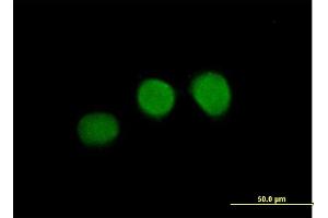 Immunofluorescence of purified MaxPab antibody to WDR45 on HeLa cell. (WDR45 Antikörper  (AA 1-360))