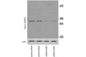 Western Blotting (WB) image for anti-Synovial Apoptosis Inhibitor 1, Synoviolin (SYVN1) antibody (ABIN2995229) (SYVN1 Antikörper)