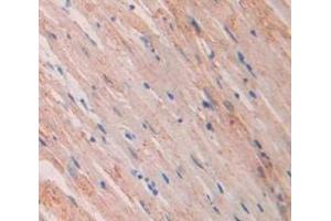 IHC-P analysis of Rat Tissue, with DAB staining. (NPPA Antikörper  (AA 25-122))