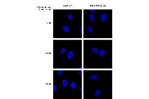 Immunocytochemistry/Immunofluorescence analysis using Mouse Anti-VPS35 Monoclonal Antibody, Clone 8A3 (ABIN6932978). (VPS35 Antikörper  (PE))