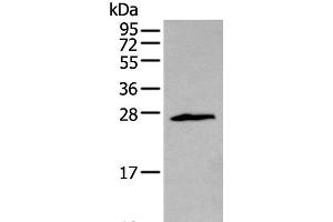 Western blot analysis of Jurkat cell using ZNF22 Polyclonal Antibody at dilution of 1:400 (Zinc Finger Protein 22 Antikörper)